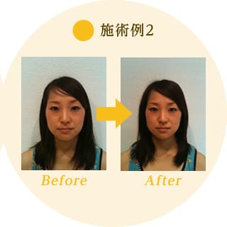 施術例2